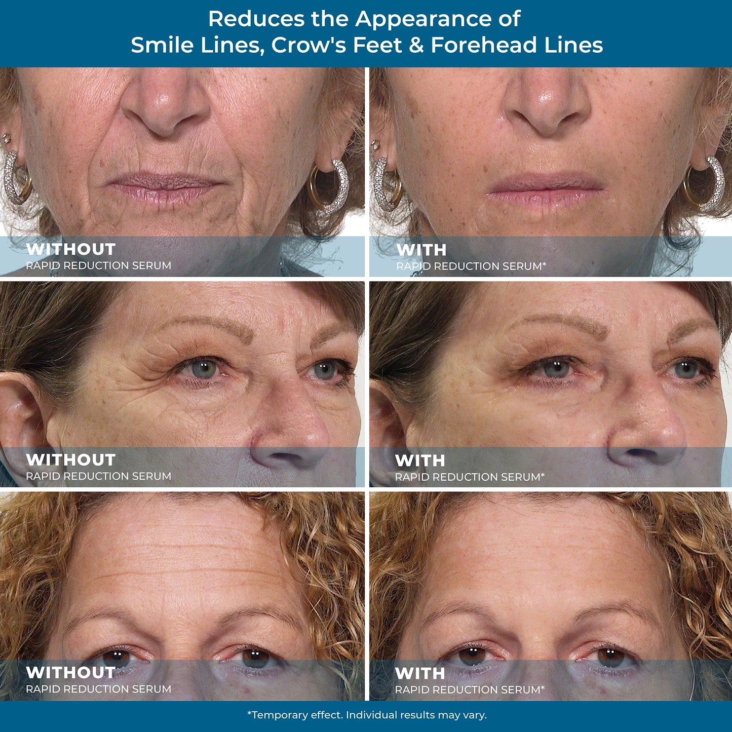 Plexaderm Rapid Reduction Eye Serum